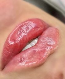 IMG_1150
